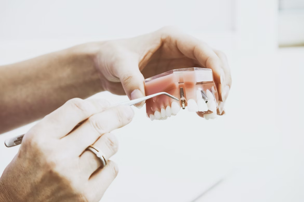 a dental professional showing how a dental implant is placed into the jaw