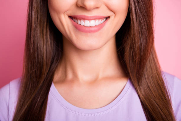 image of a woman's beautiful smile